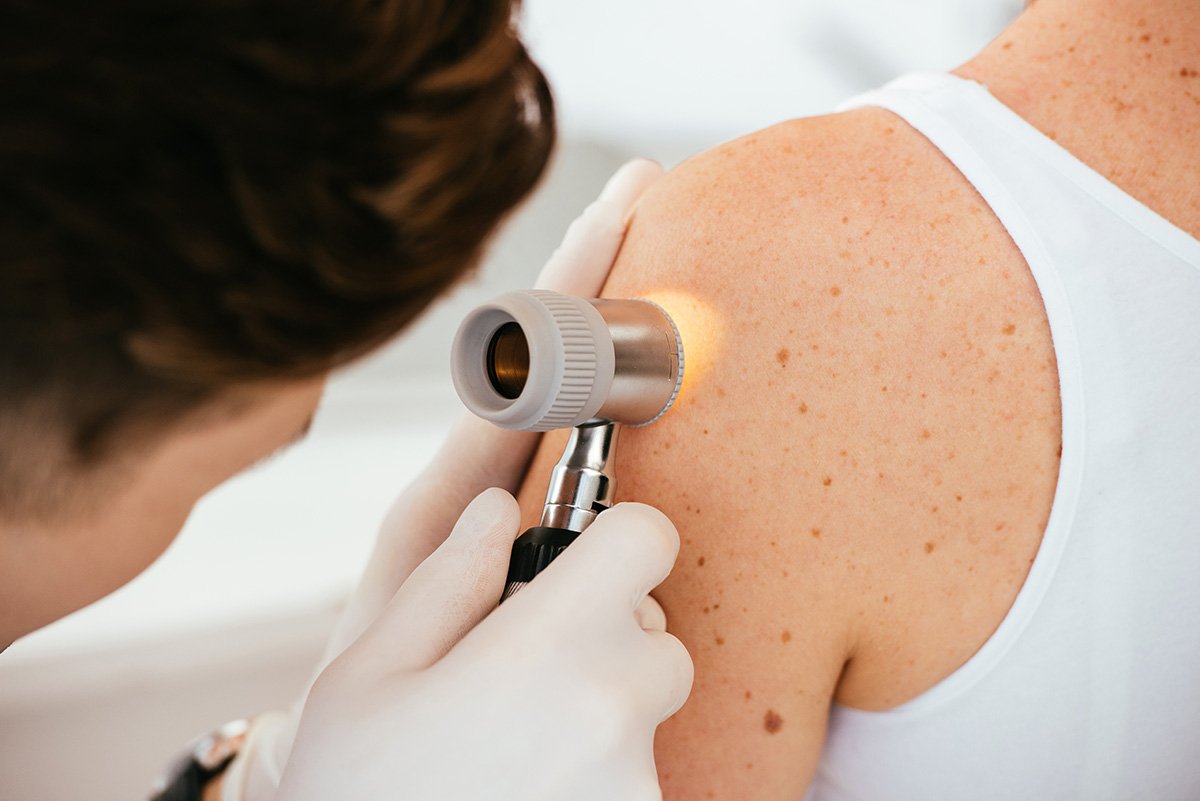 Skin Checks